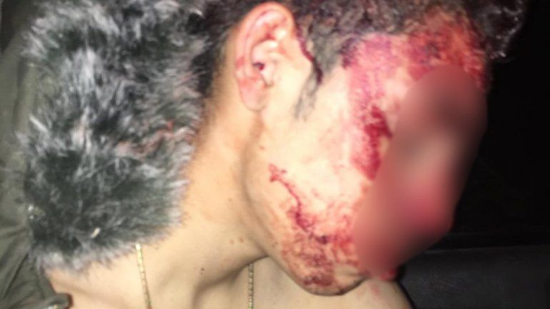 Denuncian brutal ataque a un adolescente: le tajearon la cabeza con un hierro