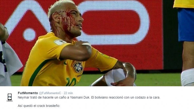 El delantero tiró un caño y recibió un codazo tremendo.