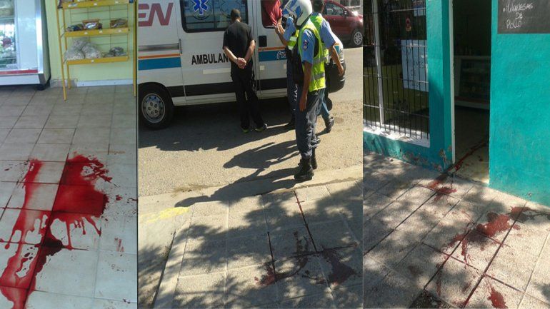 Un comerciante se defendió a cuchillazos de tres ladrones e hirió a uno