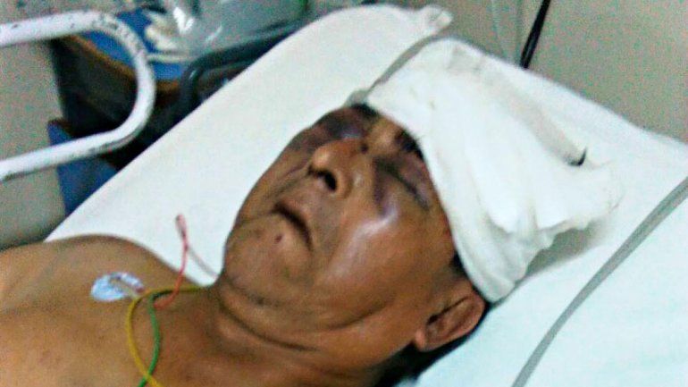 Quedó con preventiva por un salvaje robo a un abuelo