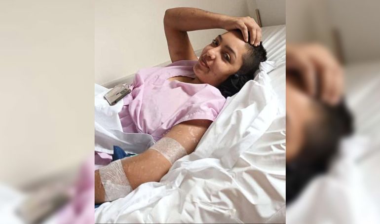 Patricia fue sometida a una nueva cirugía por el ataque de la jauría.&nbsp;