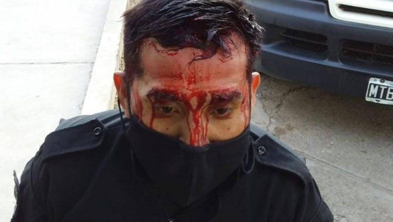 Salvaje agresión a policías que frenaron un torneo de fútbol