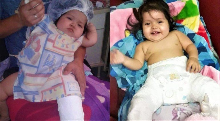 Nació con la cadera desplazada, la operaron 3 veces y sigue igual