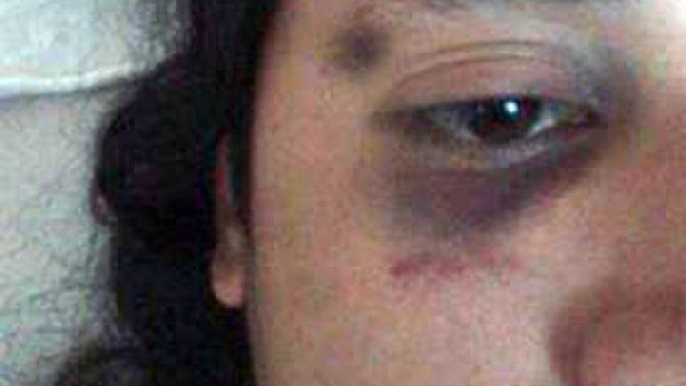 Investigan a policías por presunta golpiza a un joven mapuche