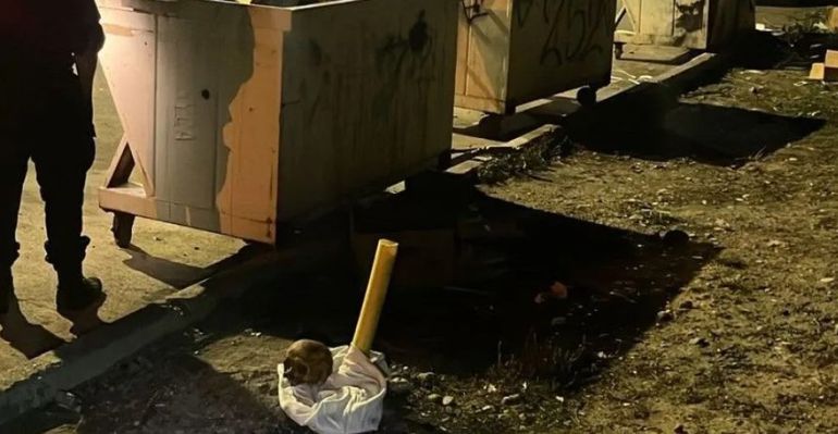 Chubut: aparecío un cráneo humano en un contenedor de basura de Trelew. Chubut: aparecío un cráneo humano en un contenedor de basura de Trelew.