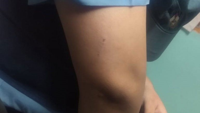 Policías lo perseguían por violar el aislamiento y les largó sus pitbulls