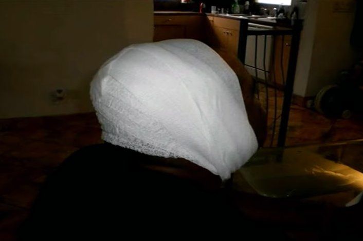 El hombre atacado pasó un mes en el hospital, con la cara desfigurada.