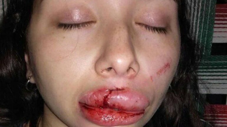 Intentaron violarla y le desfiguraron la cara