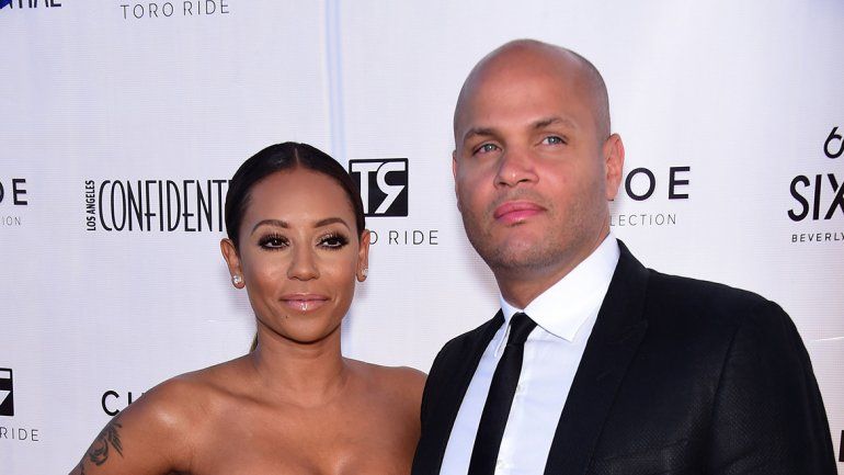 Mel B reveló una extraña cirugía para olvidar a su ex