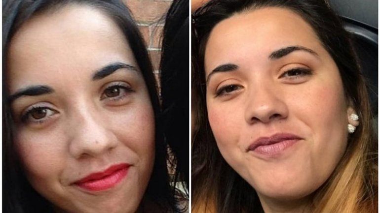 Dos pitbull mataron a su dueña argentina