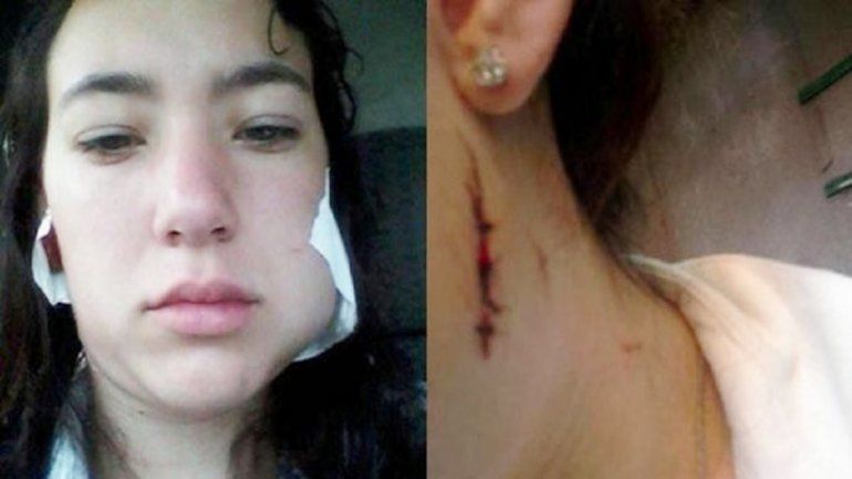 Las marcas son elocuentes. Hasta le cortó la lengua para que no pidiera ayuda.