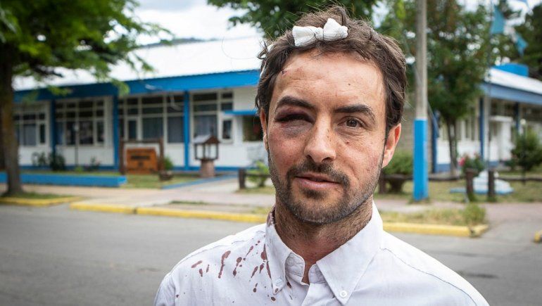 Un abogado recibió brutal ataque en pleno centro de San Martín