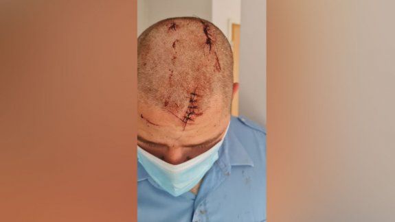 Brutal golpiza a efectivo policial neuquino en plena calle