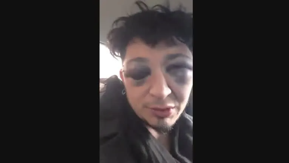 En el hospital de Santa Cruz donde lo atendieron, a Ariel Carrizo le dijeron que es muy posible que pierda la visión del ojo izquierdo.
