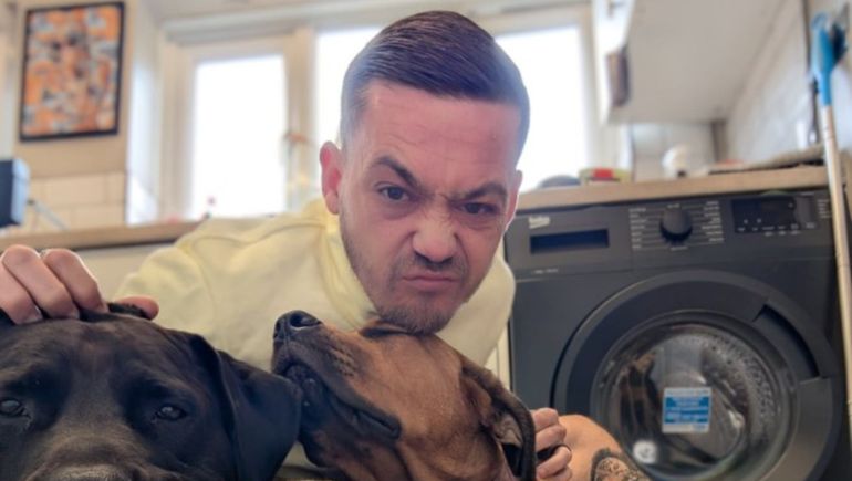 El hombre tiene ahora 33 años y se encuentra mucho mejor gracias a un dispositivo que le implantaron quirúrgicamente.