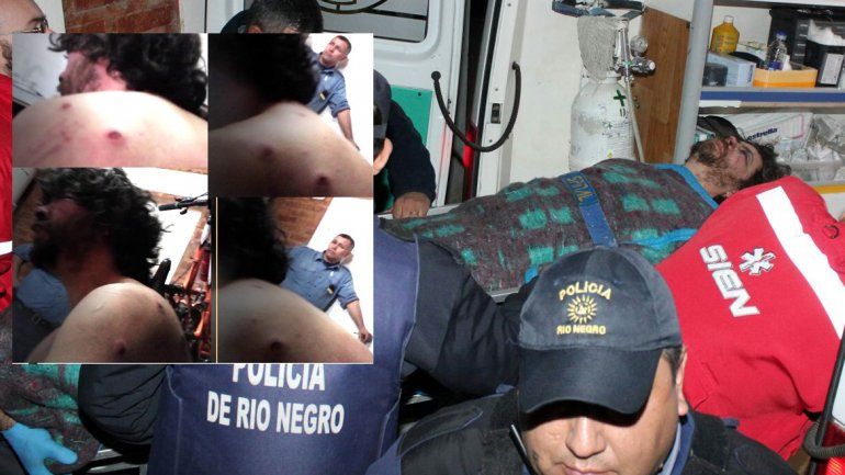 Una familia  denunció brutalidad policial para detener a un hombre: le dieron 7 balazos de goma