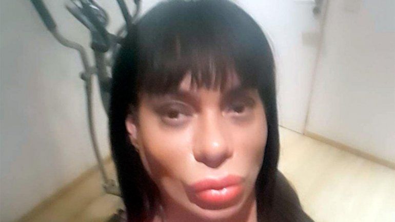 Oriana Junco denunció que un policía la golpeó tras una pelea