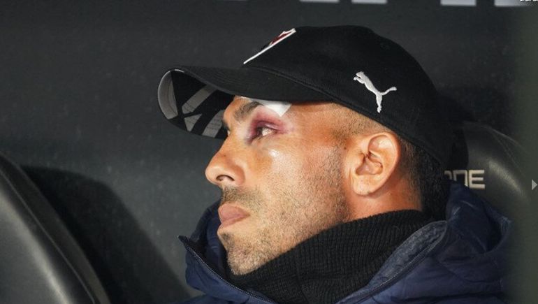 Carlos Tevez se golpeó en el baño de su casa.