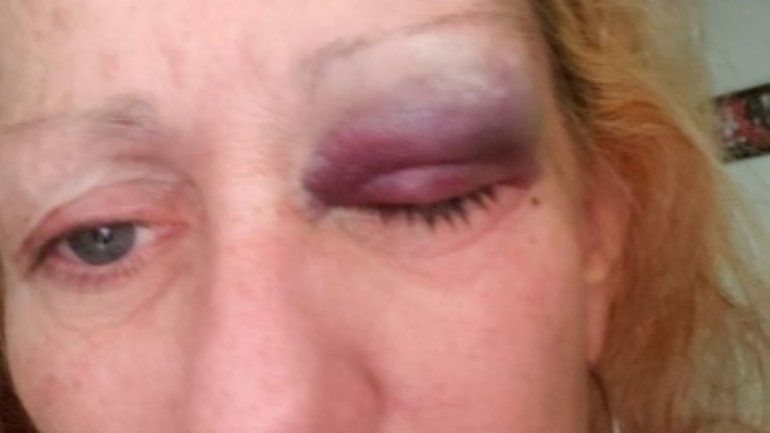 La víctima había hecho 40 denuncias por violencia de género contra su ex pareja.