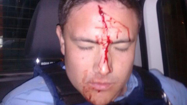 El agente de la 18 ensangrentado.