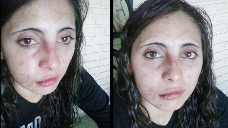 Fabiana publicó las fotos de su cara para denunciar la brutal agresión.