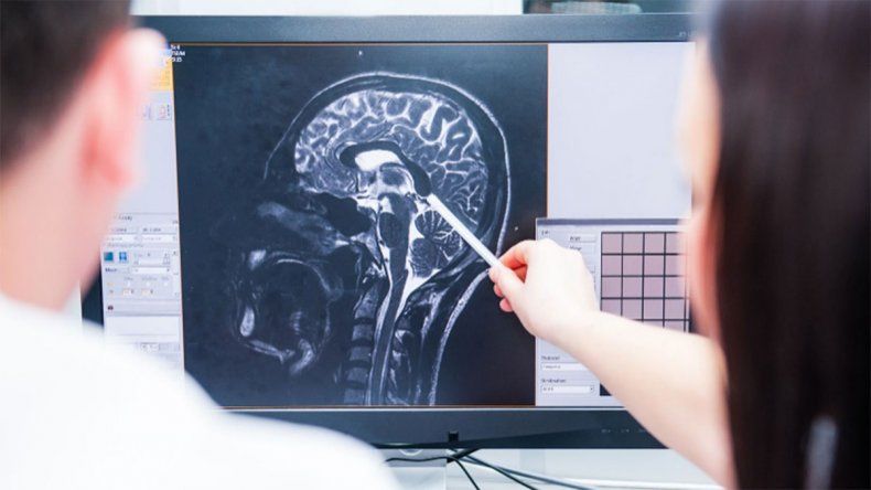 El Covid-19 daña el cerebro y lo envejece por 10 años