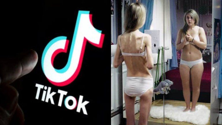 TikTok: el uso de filtros favorecería a la aparición de trastornos alimenticios