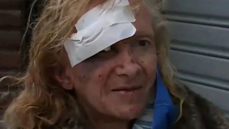 Tras el asalto, Zulma Lobato recibió ayuda de un famoso abogado