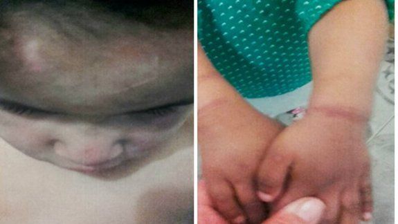 Los tres niños, de 1, 3 y 4 años, estaban desnutridos y con sarna.