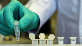 aprueban protocolo de plasma y comenzara a aplicarse aprueban protocolo de plasma y comenzara a aplicarse