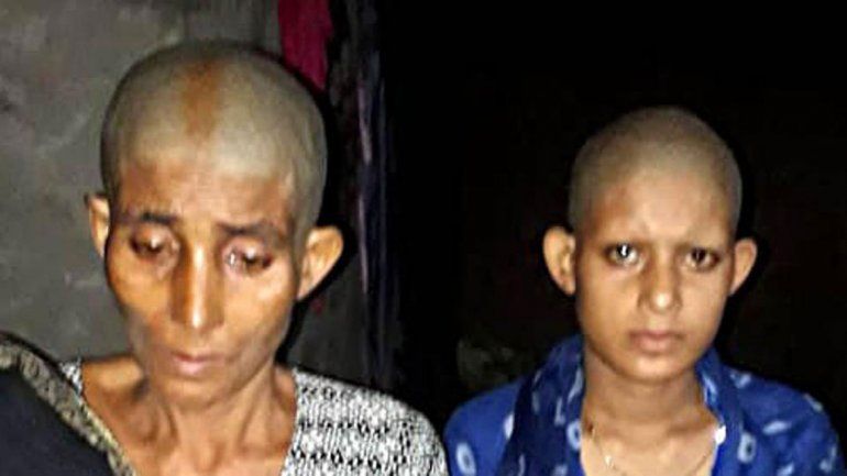 India: las raparon porque no se dejaron violar