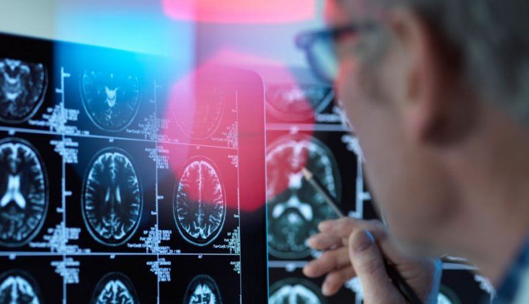 Covid-19: descubrieron cómo ingresa el virus al cerebro
