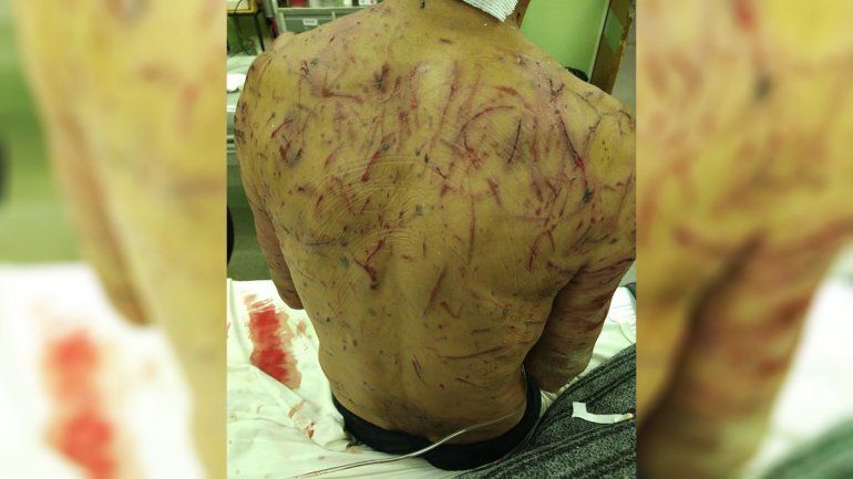 Una jauría atacó salvajemente a un hombre en la zona de El 30 y casi lo matan