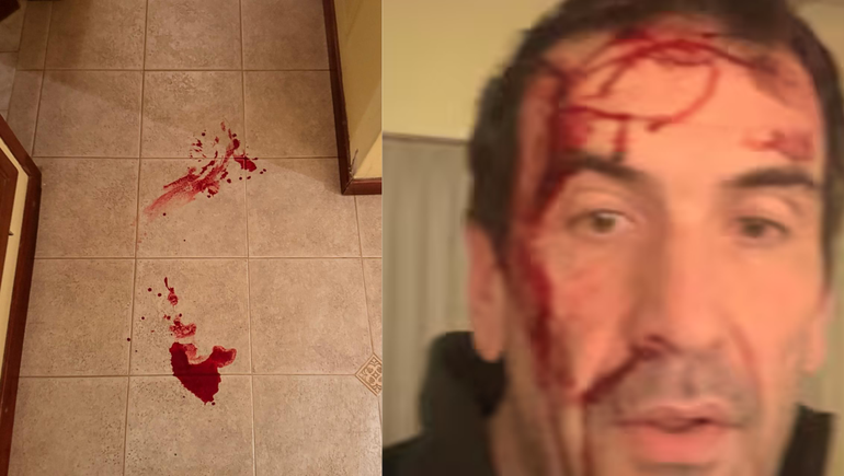 Violento robo a Pablo Cervi: por qué la Justicia decidió unificar la causa con otros asaltos | LM Neuquen Violento robo a Pablo Cervi: por qué la Justicia decidió unificar la causa con otros asaltos