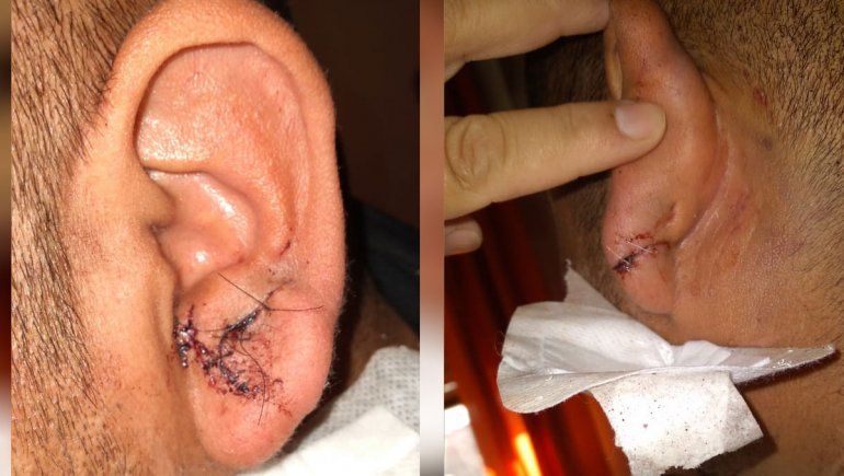 Discapacitado denunció que lo golpearon camioneros