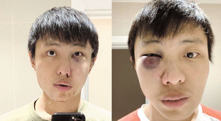 Coronavirus: le pegan a un joven sólo por ser asiático
