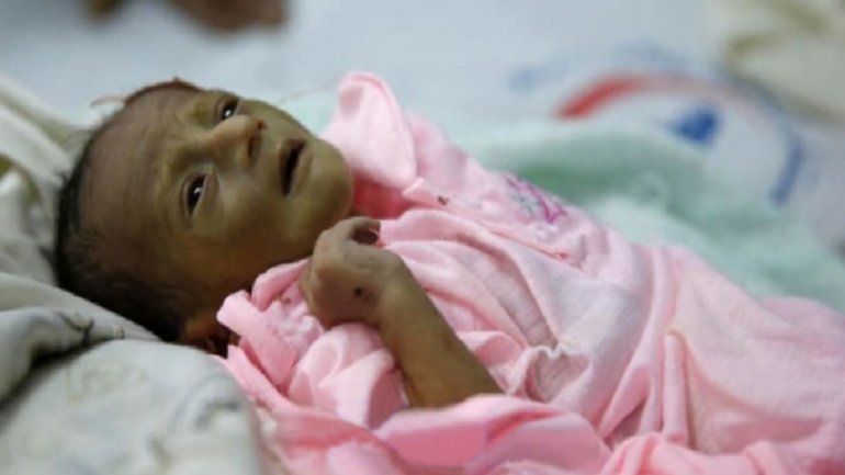 El boliviano también tiene un cuadro de parálisis cerebral e hipotermia.