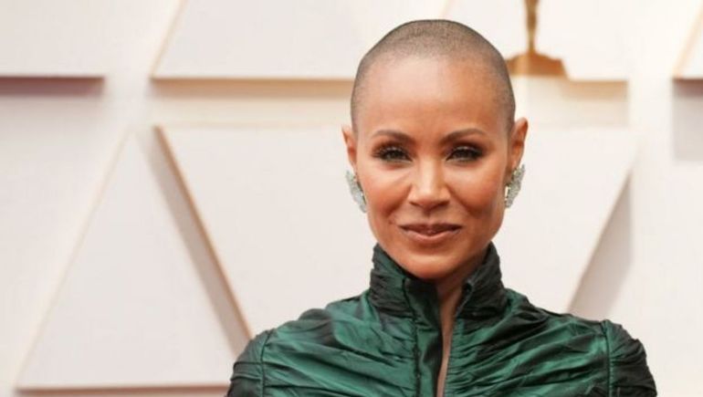 ¿Qué es la alopecia? La enfermedad que desató el escándalo en los Oscar