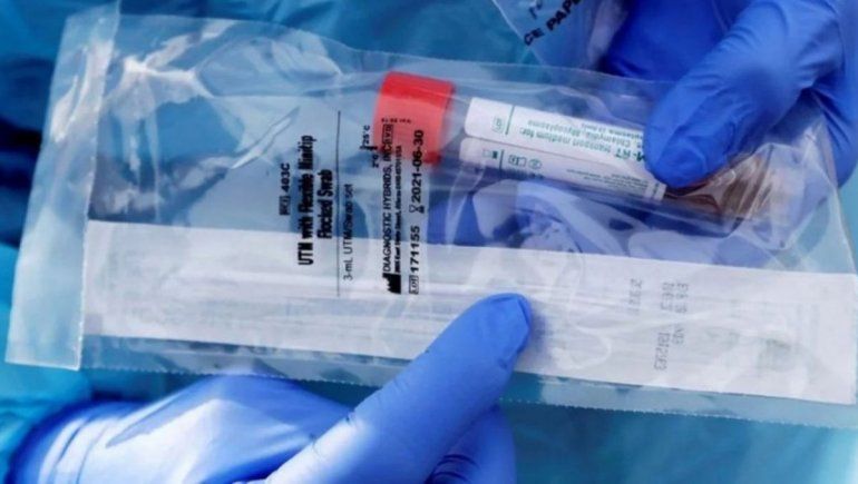 Llegaron reactivos para hacer los test del coronavirus