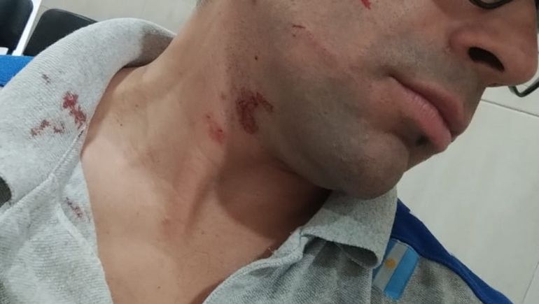 El playero realizó la denuncia policial. El playero realizó la denuncia policial.