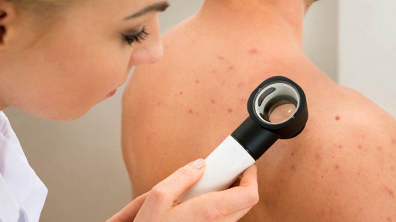 Un especialista atenderá de forma gratuita para detectar una extraña enfermedad de piel