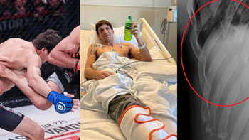 la patada mas brutal de la historia; 5 costillas rotas y pulmon perforado la patada mas brutal de la historia; 5 costillas rotas y pulmon perforado