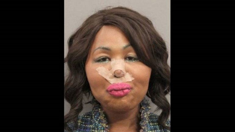 Una mujer trans robaba bancos para operarse la cara