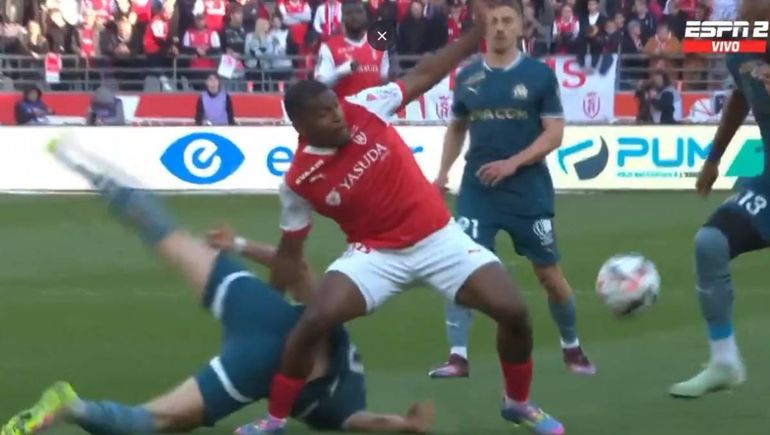 La increíble lesión que sufrió un jugador de la Selección jugando en Europa: el video