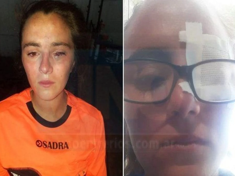 Jugadoras le patean la cabeza a la jueza que tiene un ojo comprometido