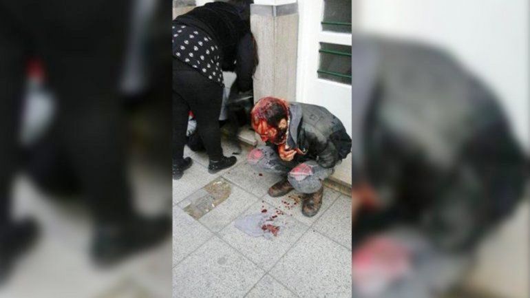 A consecuencia del accionar delictivo de los grupos neonazis