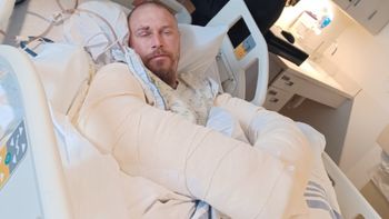 La pelea entre la perra y su dueño duró unos 45 minutos. Luego el hombre debió tomar una decisión extrema. La pelea entre la perra y su dueño duró unos 45 minutos. Luego el hombre debió tomar una decisión extrema.