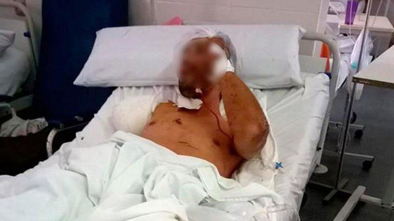 Un Pitbull atacó a un ladrón y lo dejó sin un brazo