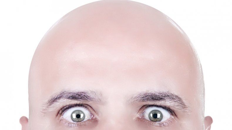 Cada 7 de octubre se celebra el Día Mundial del Pelado, una fecha para reconocer y reivindicar a quienes viven sin cabello.