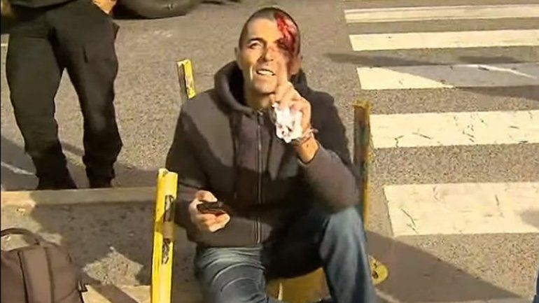 Atropellaron al fiscal del caso Odebrecht